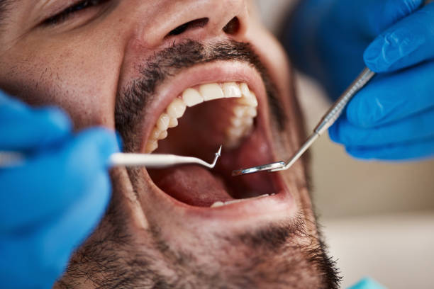 Best Emergency Gum Pain Relief  in Iowa Falls, IA